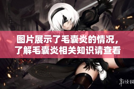 图片展示了毛囊炎的情况，了解毛囊炎相关知识请查看此图。